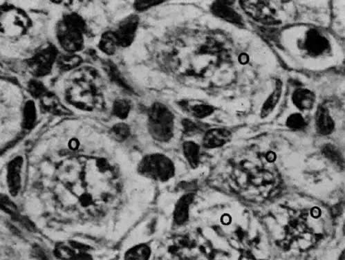 Leptotene Stage Of Meiosis