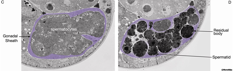 Spermatogenesis Is The Last Stage Of Meiosis