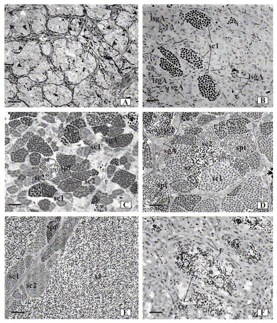 Spermatogenesis Is The Last Stage Of Meiosis