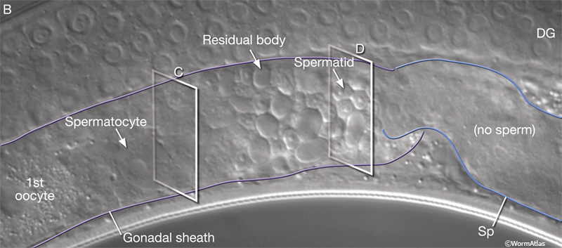 Spermatogenesis Is The Last Stage Of Meiosis