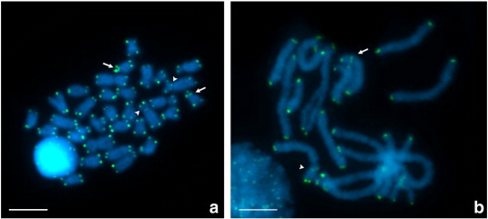 Stage Of Meiosis In Which Bivalents Become Aligned On The Metaphase Plate