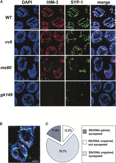 What Results From The First Stage Of Meiosis